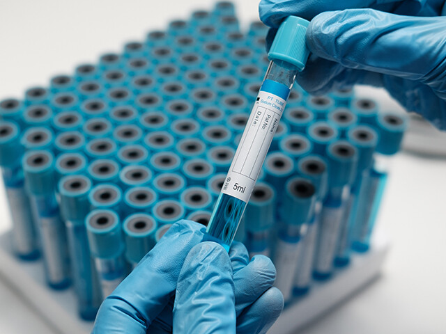 woman working with vials in a medical lab